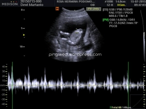 detak jantung baby B